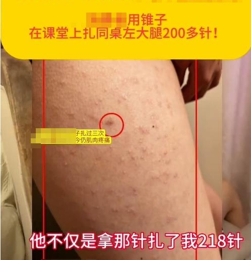 校園防欺凌報(bào)警器：“女生被同桌扎218針”，未達(dá)到校園霸凌標(biāo)準(zhǔn)？多方回應(yīng)